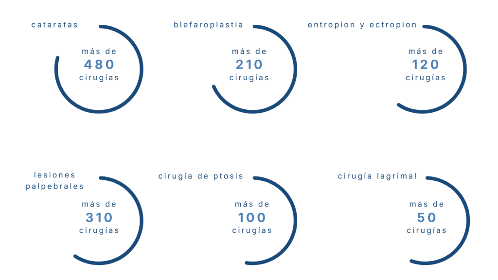 cataratas